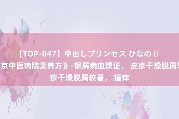 【TOP-047】中出しプリンセス ひなの ​ 润肤丸《北京中医病院素养方》-银屑病血燥证， 皮疹干燥脱屑较著， 瘙痒